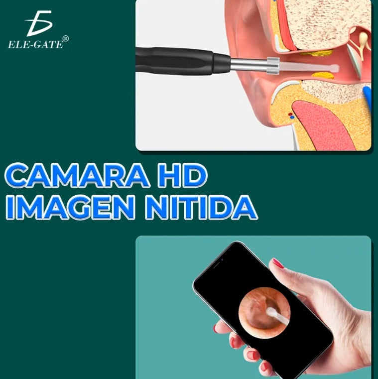 Ear Cleaner With Camera Smart Earwax Remover Endoscope