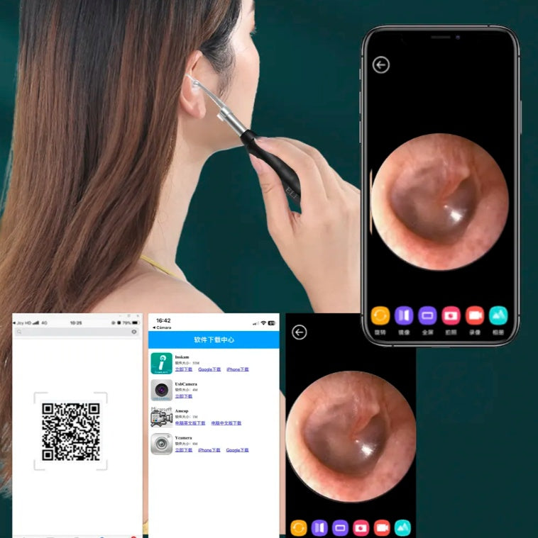 Ear Cleaner With Camera Smart Earwax Remover Endoscope